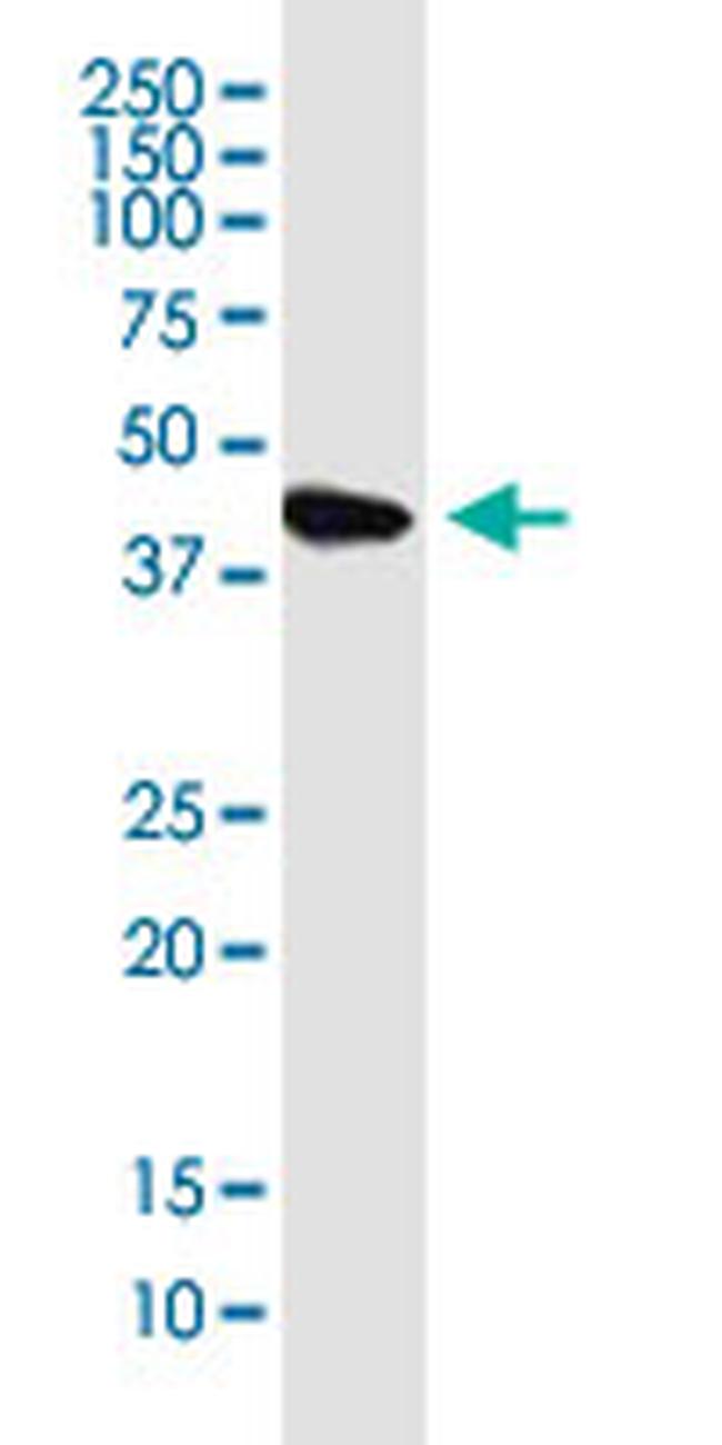 KIAA1191 Antibody in Western Blot (WB)