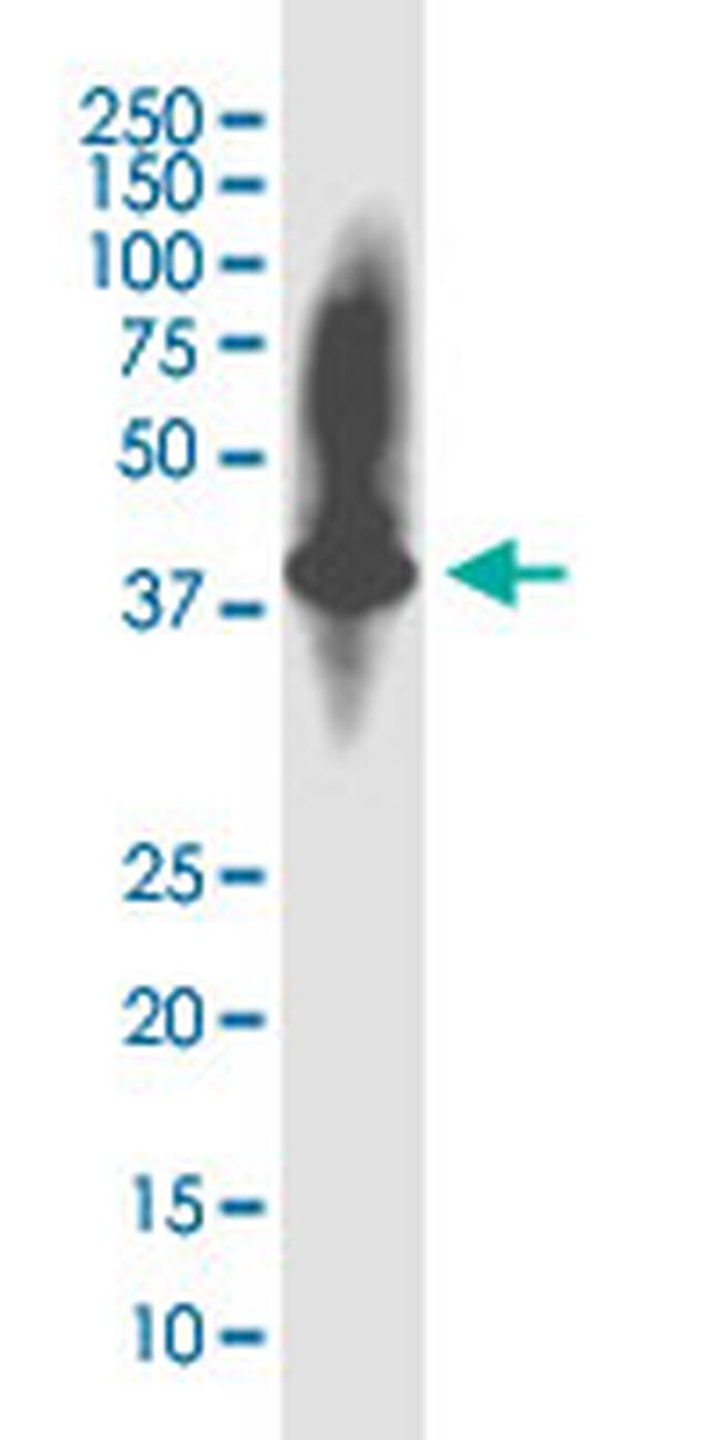 KIAA1191 Antibody in Western Blot (WB)