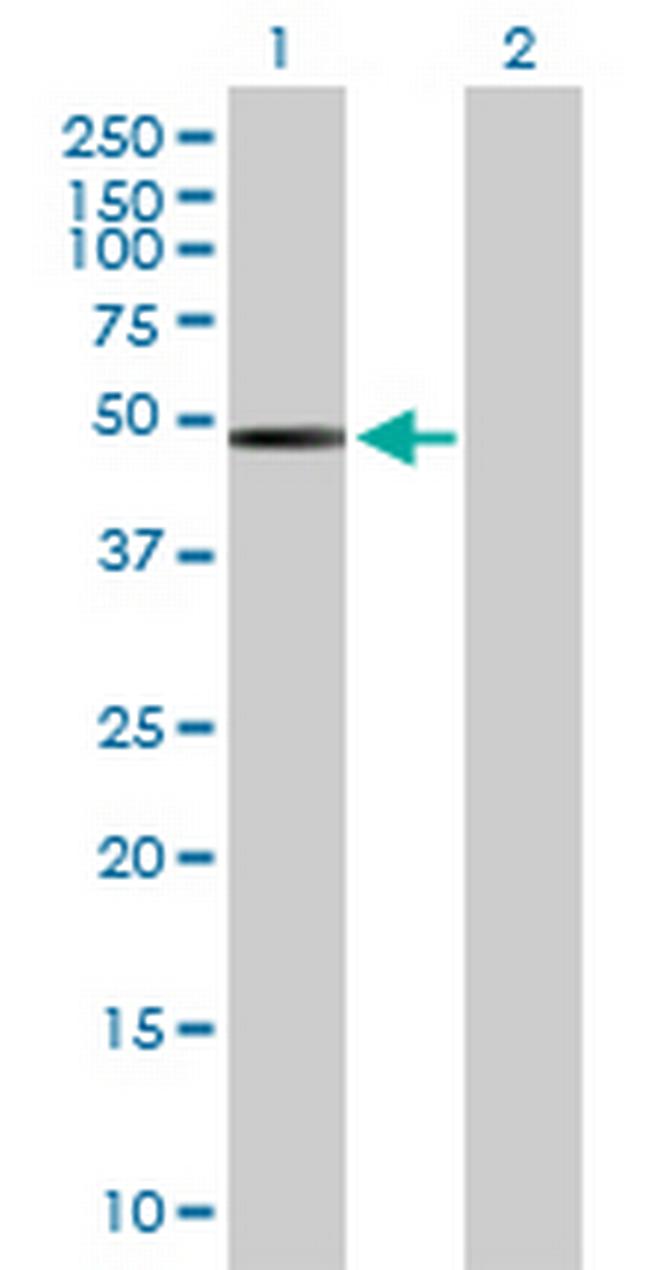 ACTR3B Antibody in Western Blot (WB)