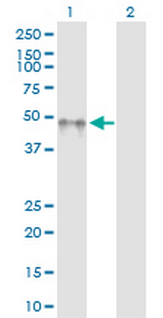 KIR2DL5A Antibody in Western Blot (WB)