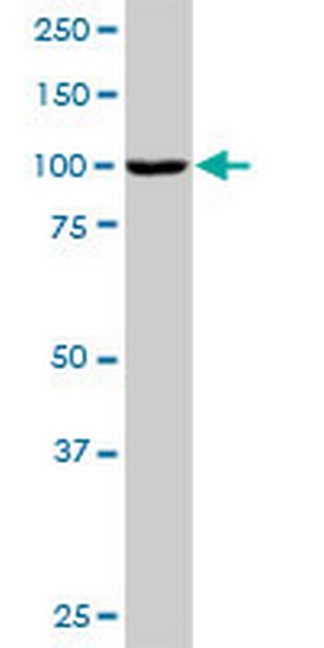 PBXIP1 Antibody in Western Blot (WB)