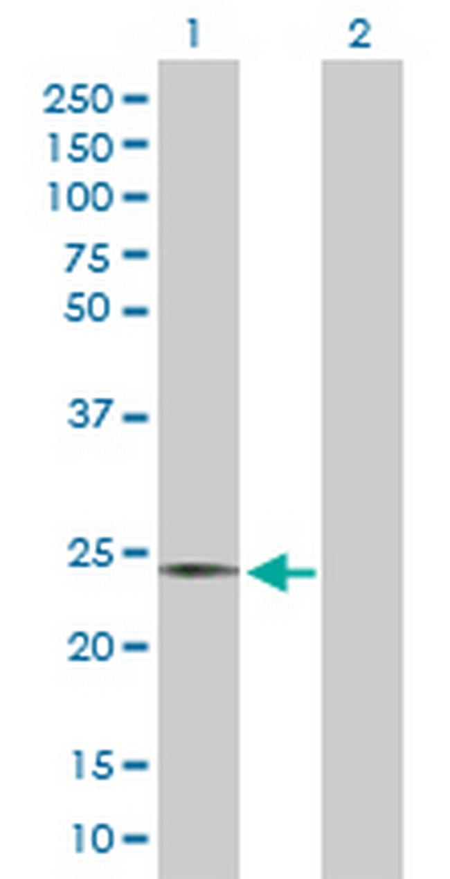 AICDA Antibody in Western Blot (WB)