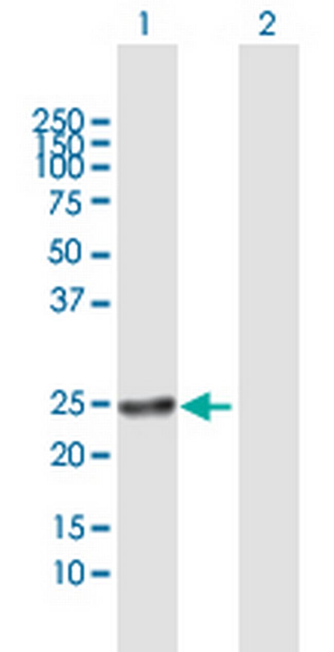 RAB22A Antibody in Western Blot (WB)