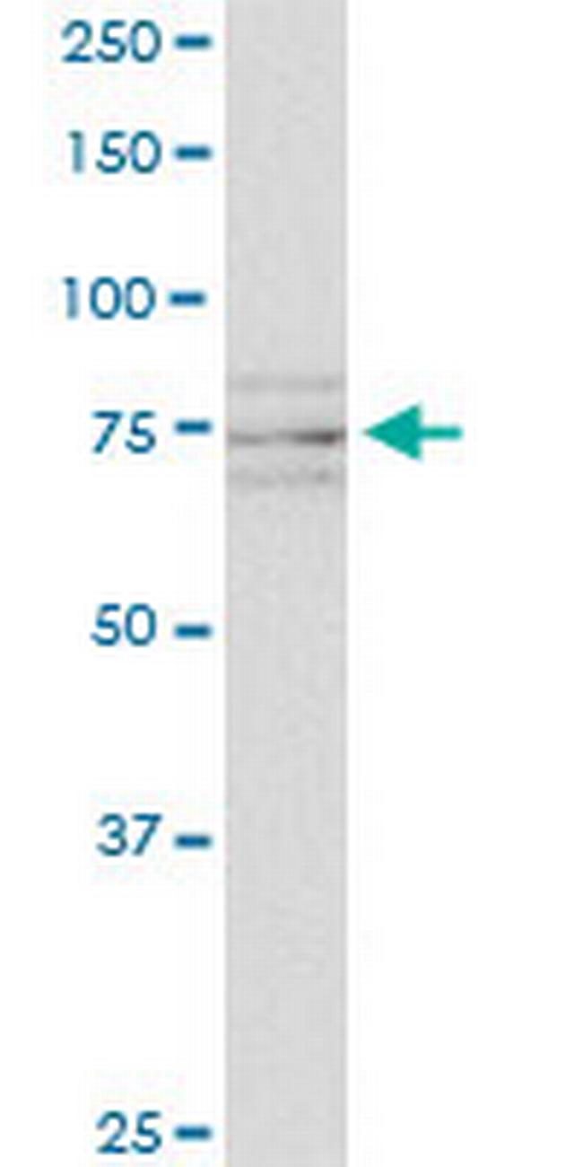 SCYL1 Antibody in Western Blot (WB)