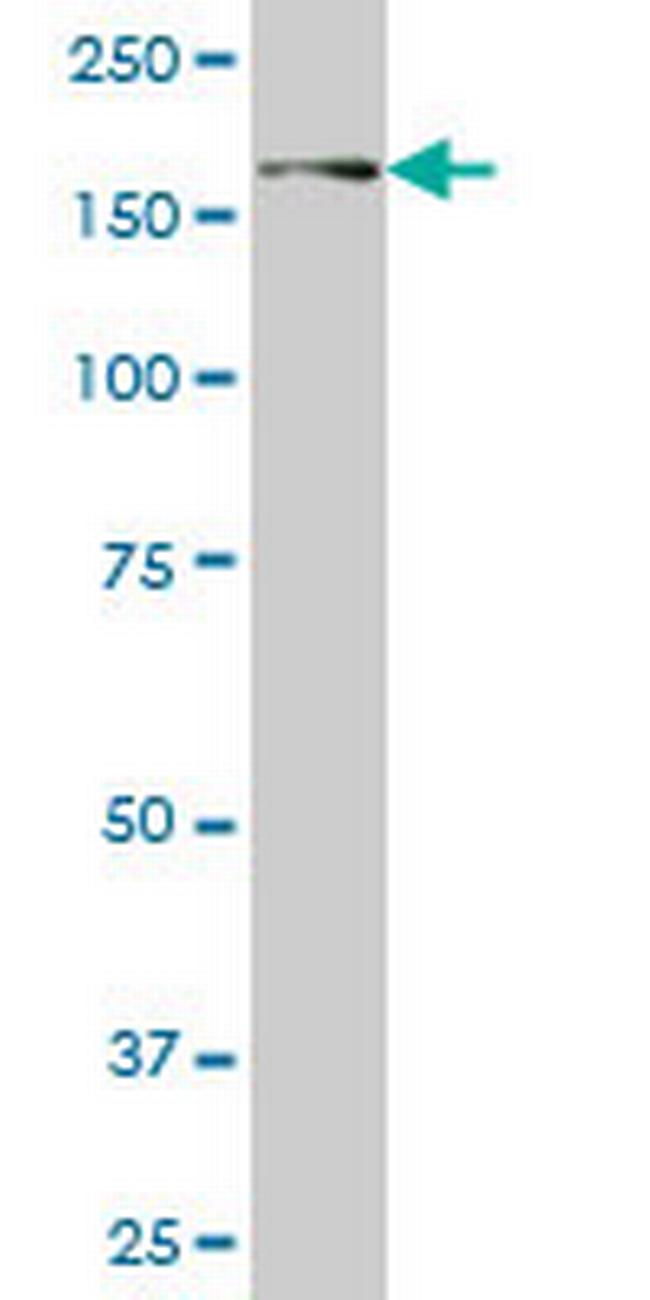 USP31 Antibody in Western Blot (WB)