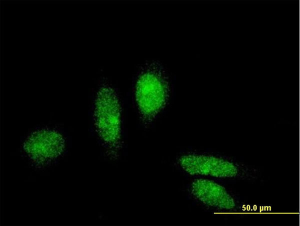 MTA3 Antibody in Immunocytochemistry (ICC/IF)