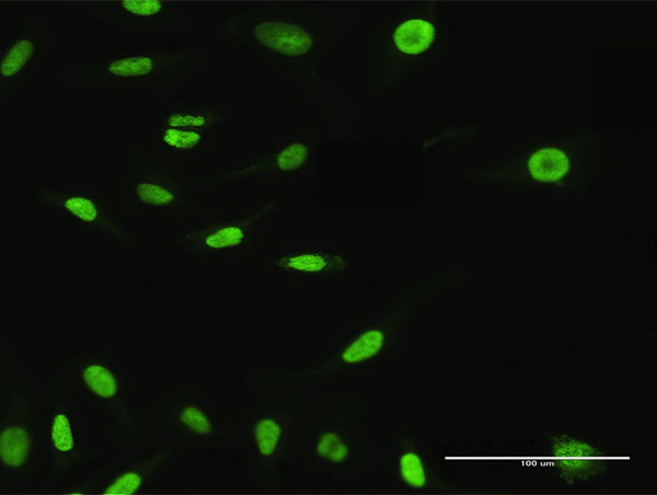 XPO5 Antibody in Immunocytochemistry (ICC/IF)