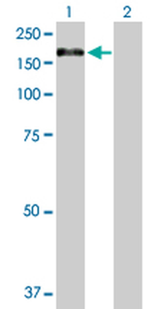 XPO5 Antibody in Western Blot (WB)