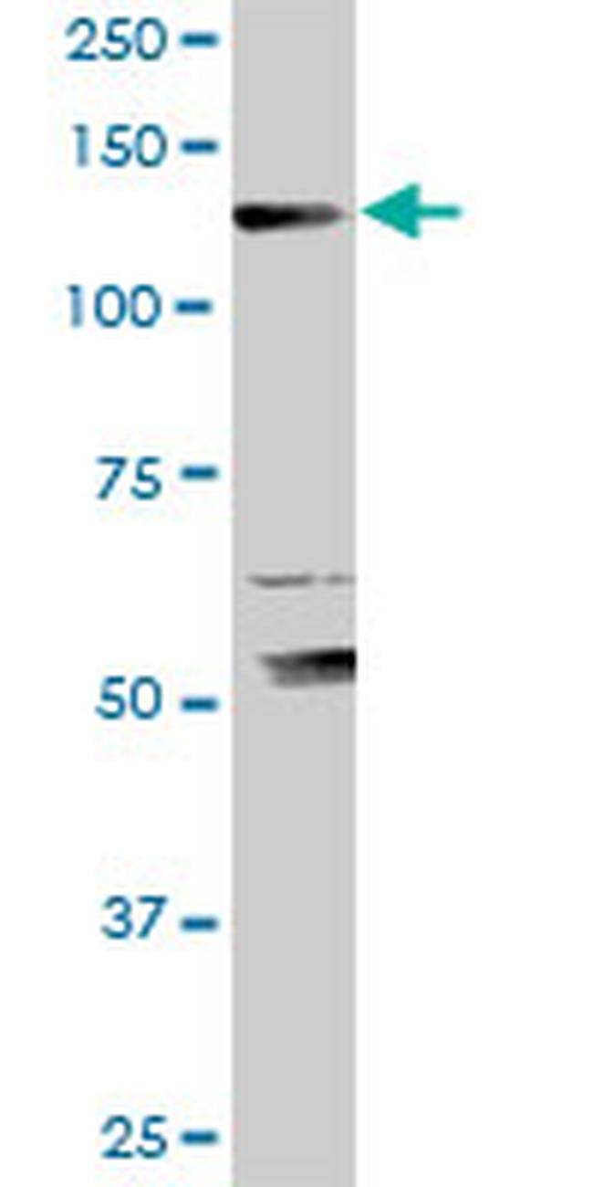 XPO5 Antibody in Western Blot (WB)