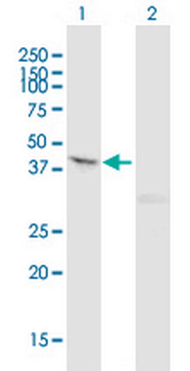 RPTOR Antibody in Western Blot (WB)