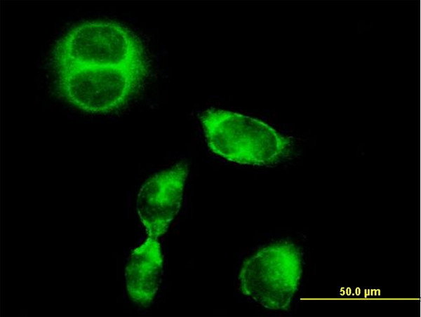 SRGAP1 Antibody in Immunocytochemistry (ICC/IF)