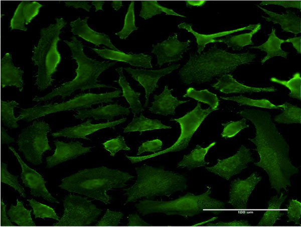 SRGAP1 Antibody in Immunocytochemistry (ICC/IF)