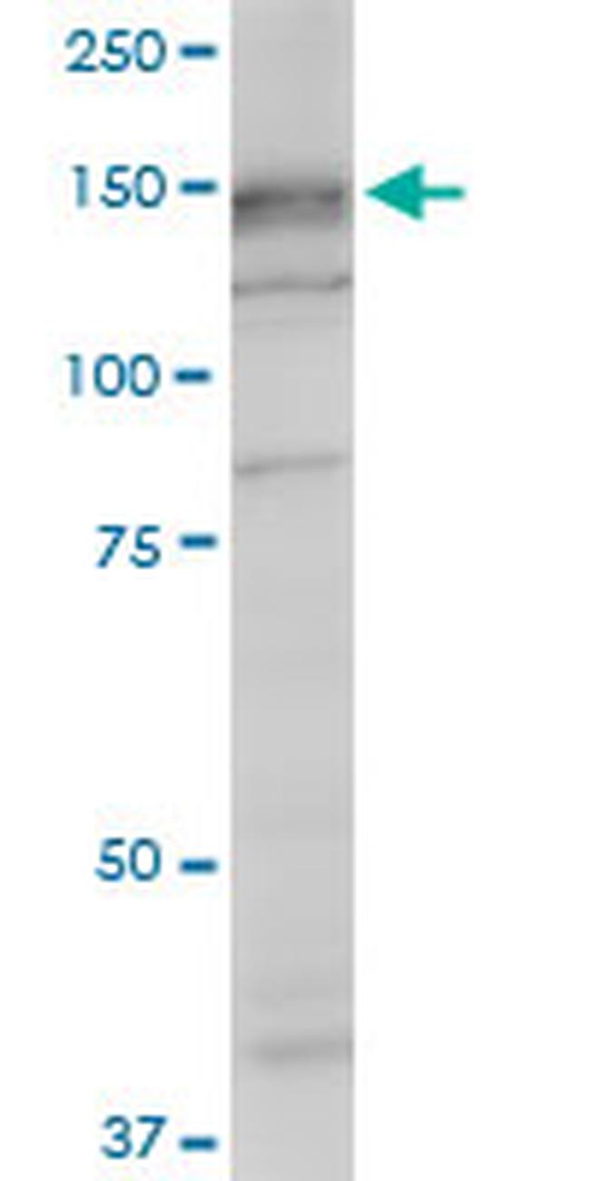 SRGAP1 Antibody in Western Blot (WB)