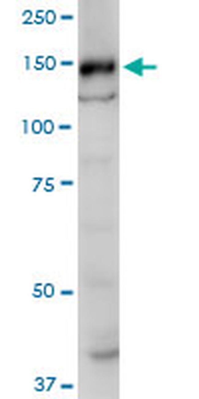 SRGAP1 Antibody in Western Blot (WB)