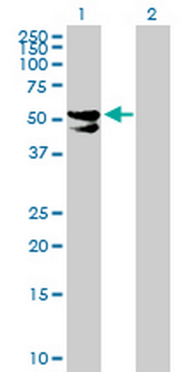 PDP2 Antibody in Western Blot (WB)