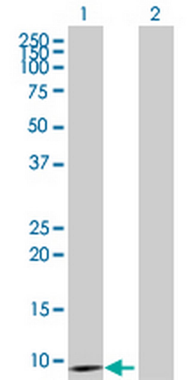 EBF4 Antibody in Western Blot (WB)