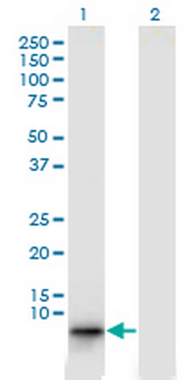 EBF4 Antibody in Western Blot (WB)