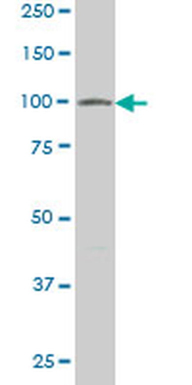 VPS18 Antibody in Western Blot (WB)