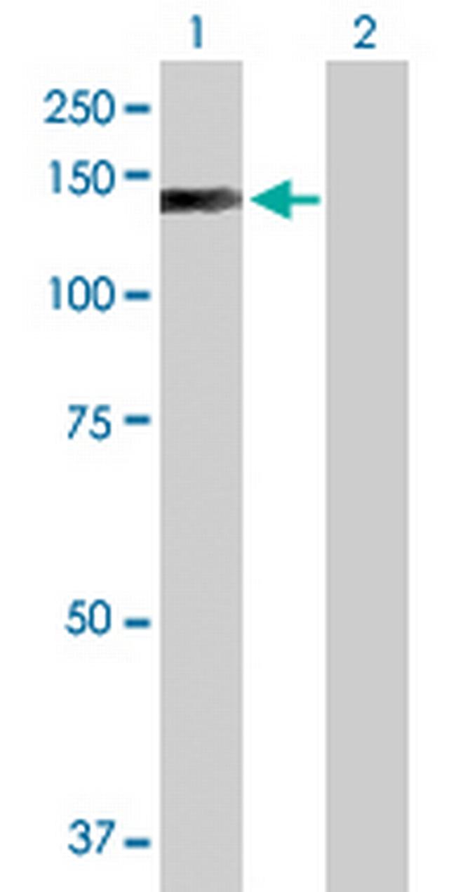 EP400 Antibody in Western Blot (WB)