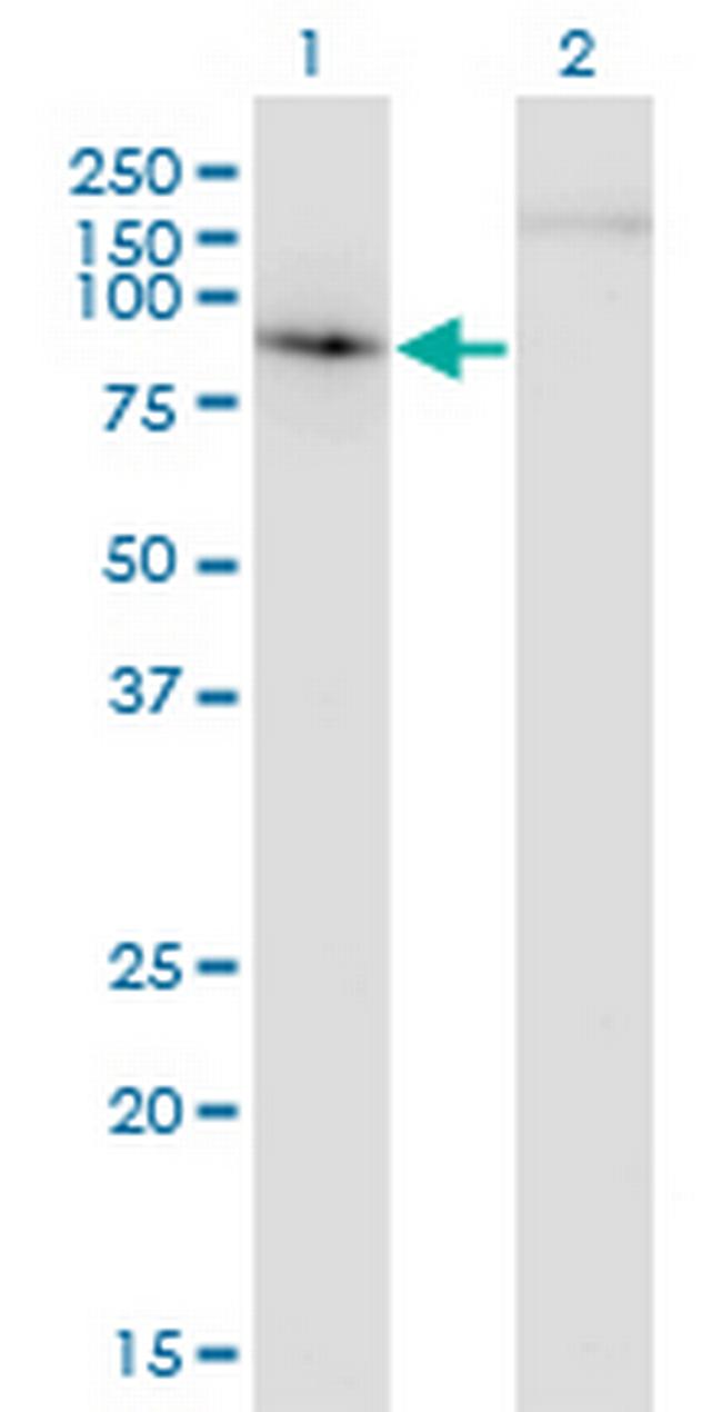 EP400 Antibody in Western Blot (WB)