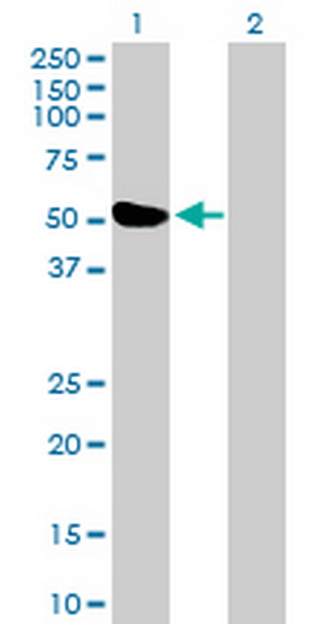 ZBTB26 Antibody in Western Blot (WB)