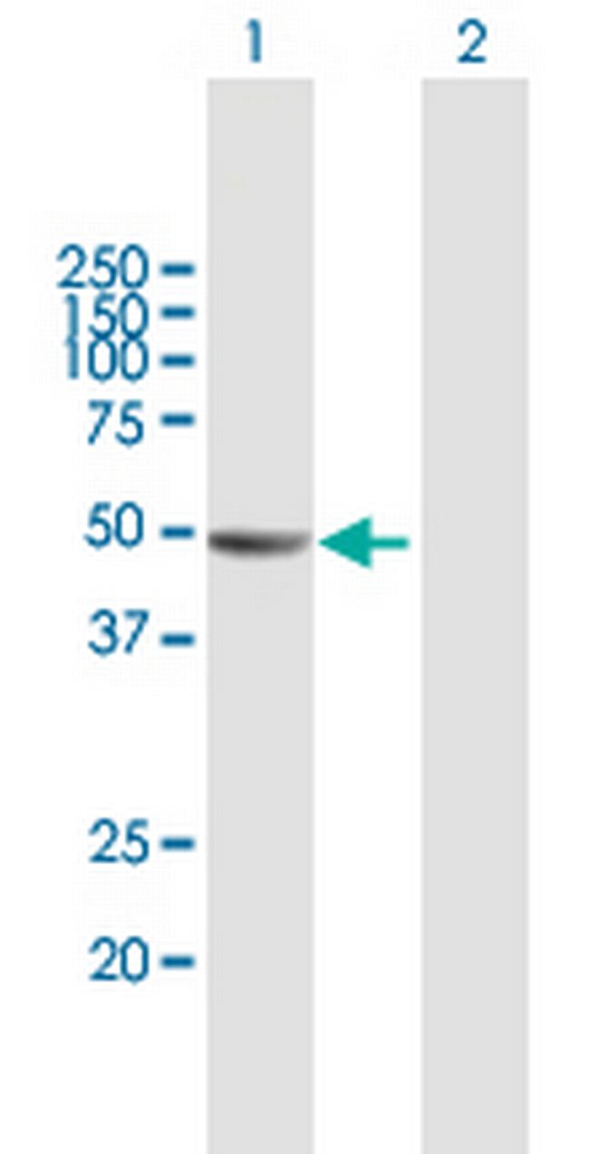 KIAA1576 Antibody in Western Blot (WB)