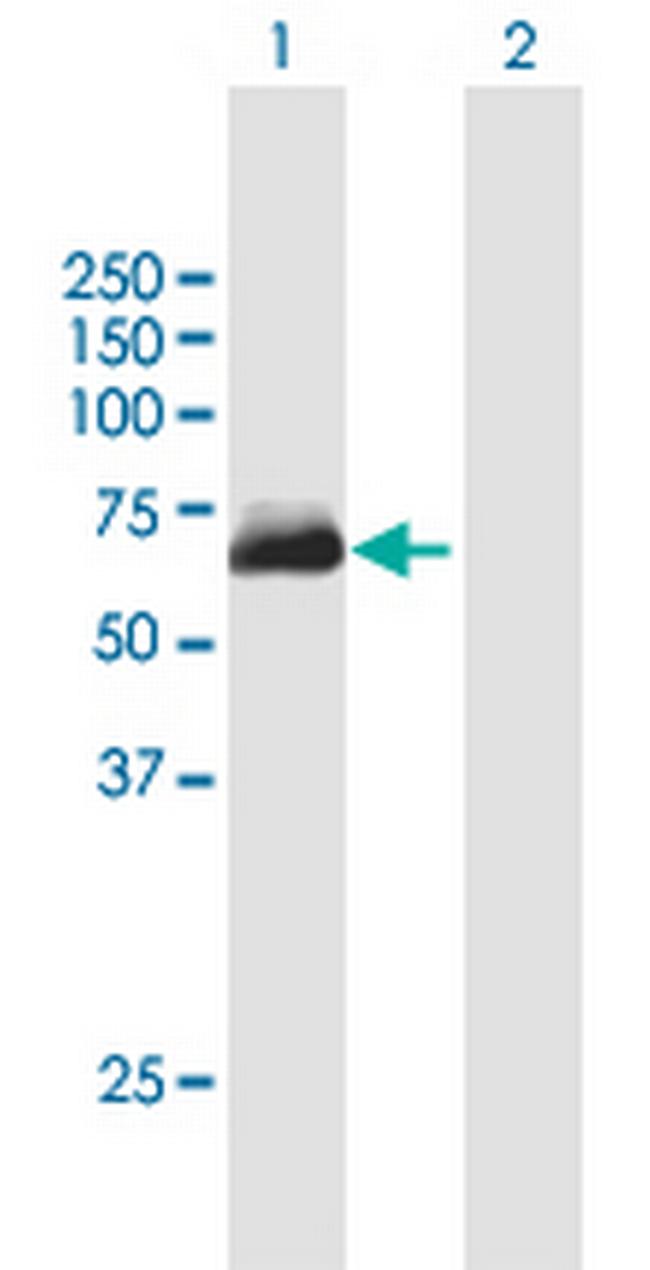 METTL14 Antibody in Western Blot (WB)