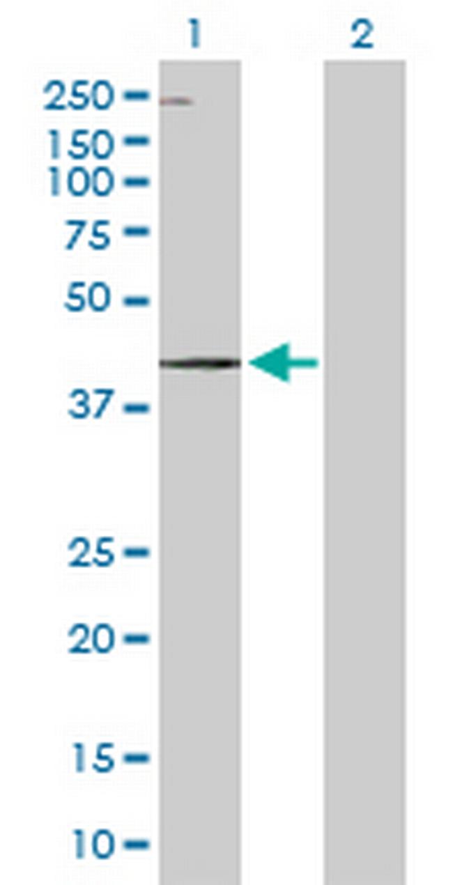 WDR19 Antibody in Western Blot (WB)