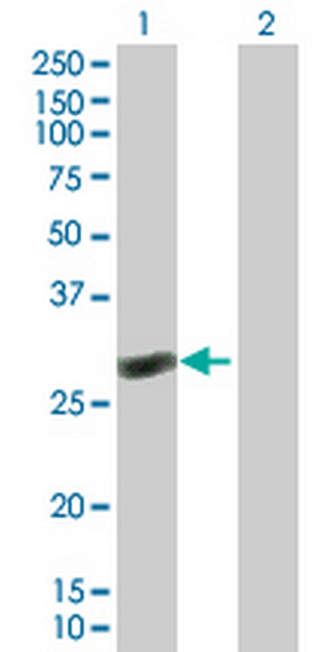 RAB40C Antibody in Western Blot (WB)