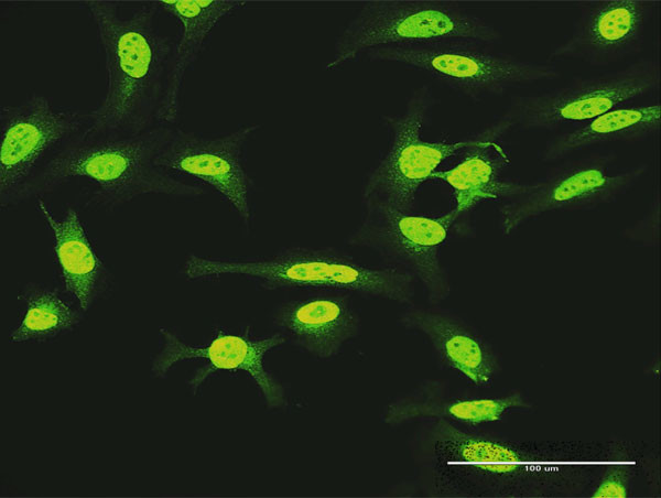 KIAA1967 Antibody in Immunocytochemistry (ICC/IF)