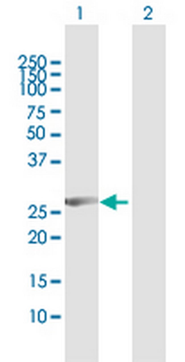 CCNB1IP1 Antibody in Western Blot (WB)