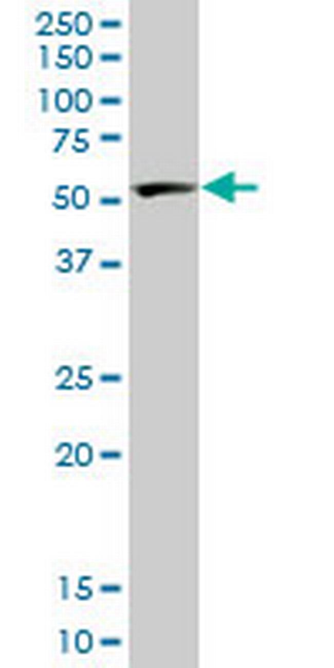 PTBP2 Antibody in Western Blot (WB)