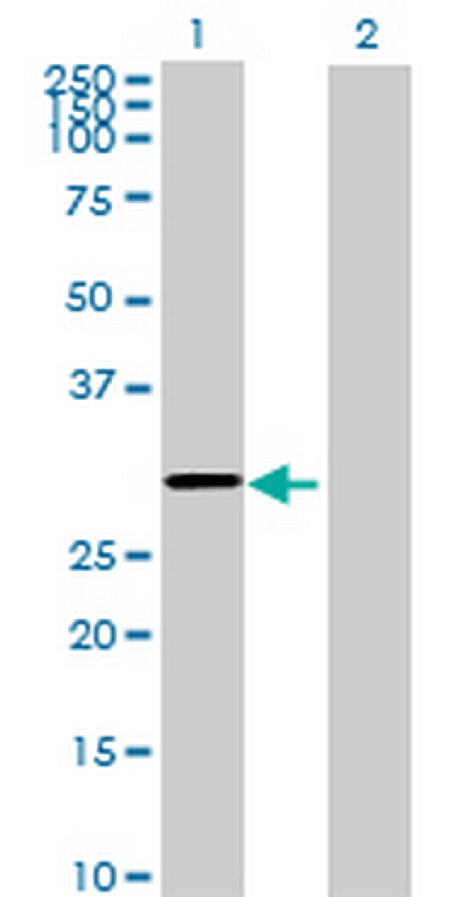 SRPRB Antibody in Western Blot (WB)