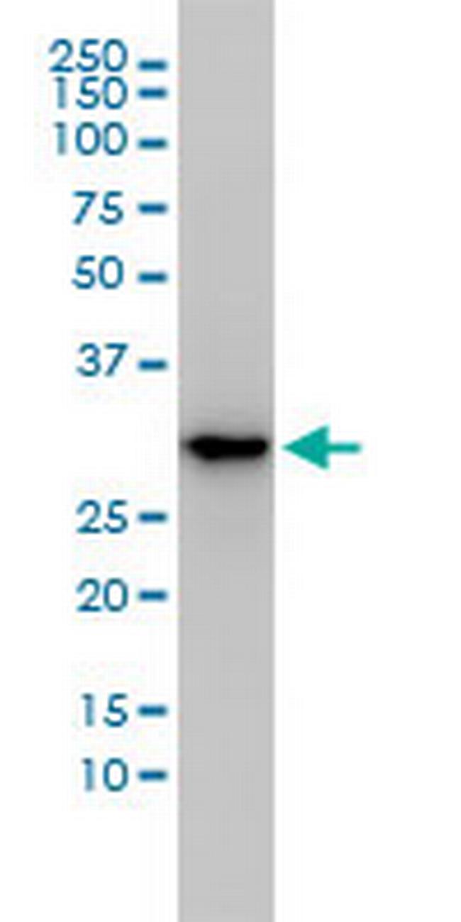 MASA Antibody in Western Blot (WB)