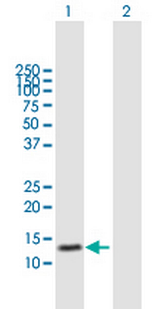 TRAPPC1 Antibody in Western Blot (WB)