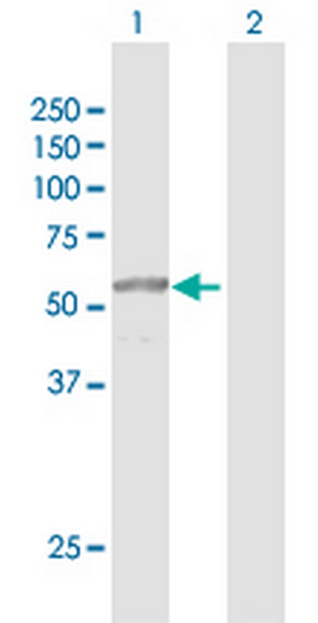 PRUNE Antibody in Western Blot (WB)