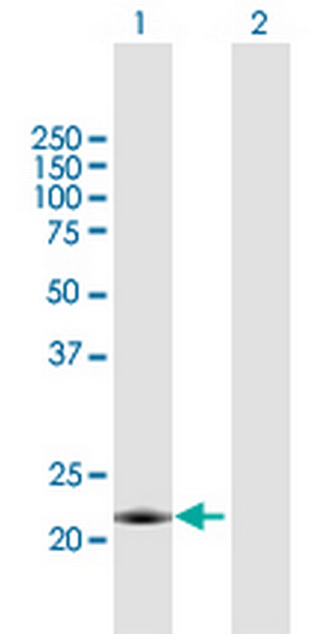 MID1IP1 Antibody in Western Blot (WB)