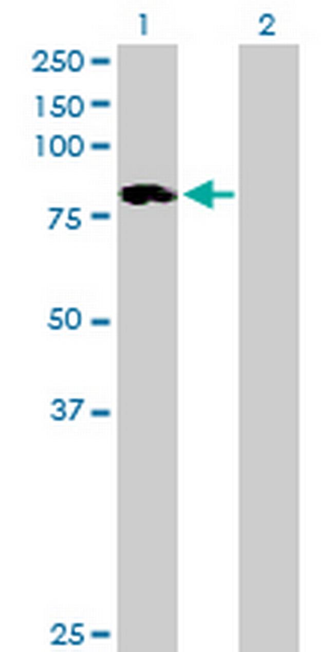 ALOXE3 Antibody in Western Blot (WB)