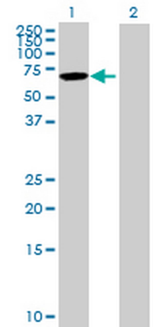 KLHL12 Antibody in Western Blot (WB)