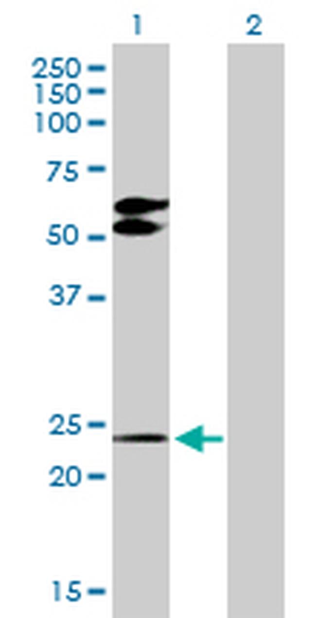 TGIF2 Antibody in Western Blot (WB)