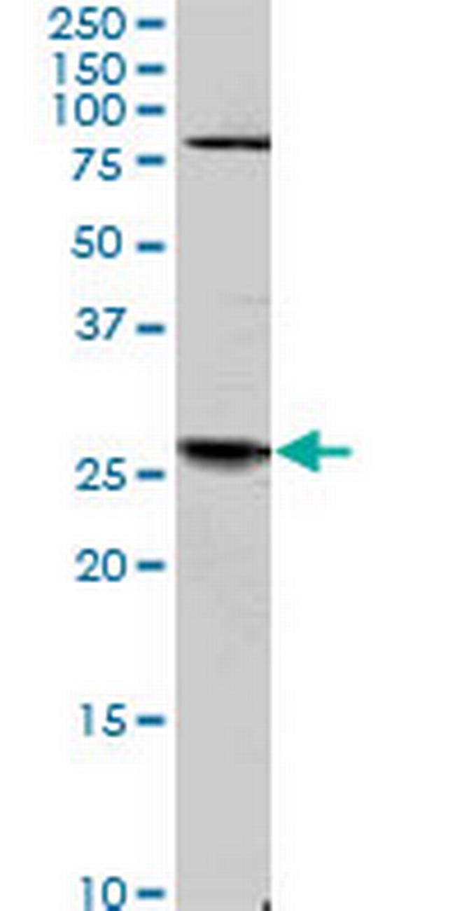 TGIF2 Antibody in Western Blot (WB)