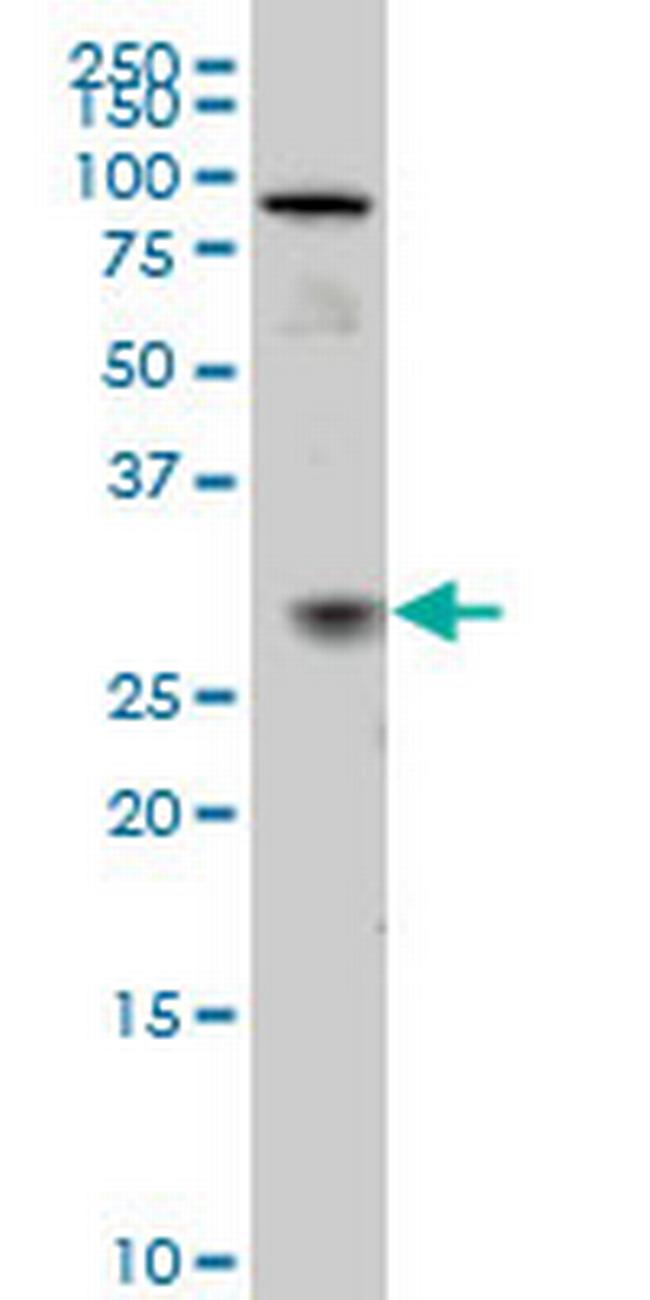 TGIF2 Antibody in Western Blot (WB)