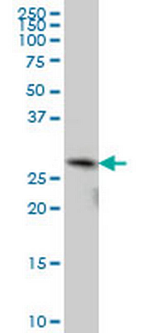 TGIF2 Antibody in Western Blot (WB)