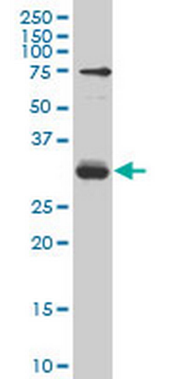 TGIF2 Antibody in Western Blot (WB)