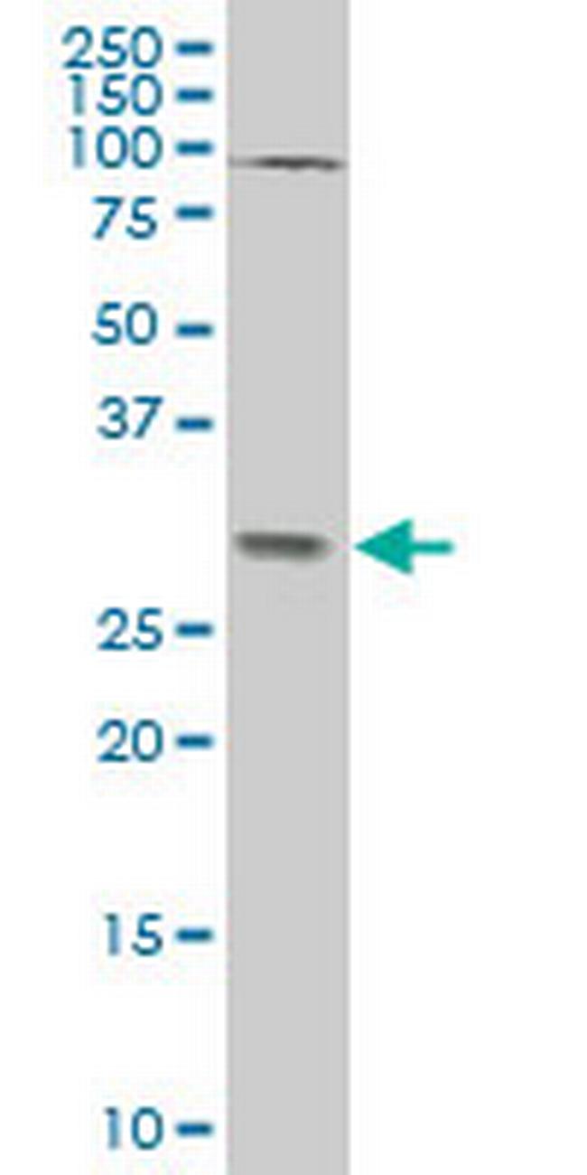 TGIF2 Antibody in Western Blot (WB)