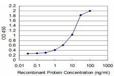 TGIF2 Antibody in ELISA (ELISA)