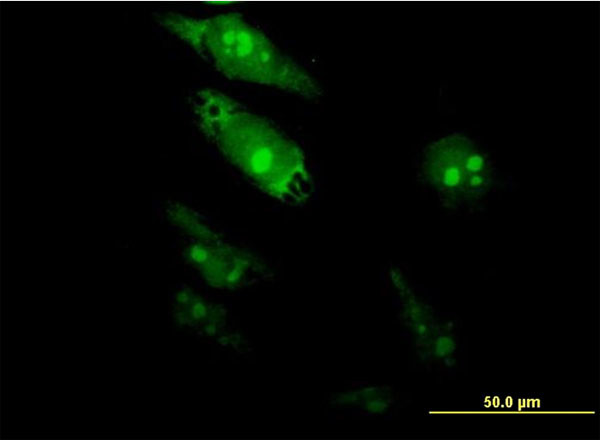 TGIF2 Antibody in Immunocytochemistry (ICC/IF)