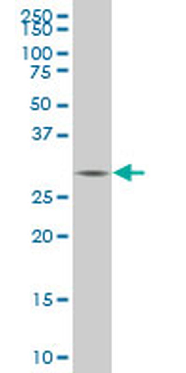 TGIF2 Antibody in Western Blot (WB)