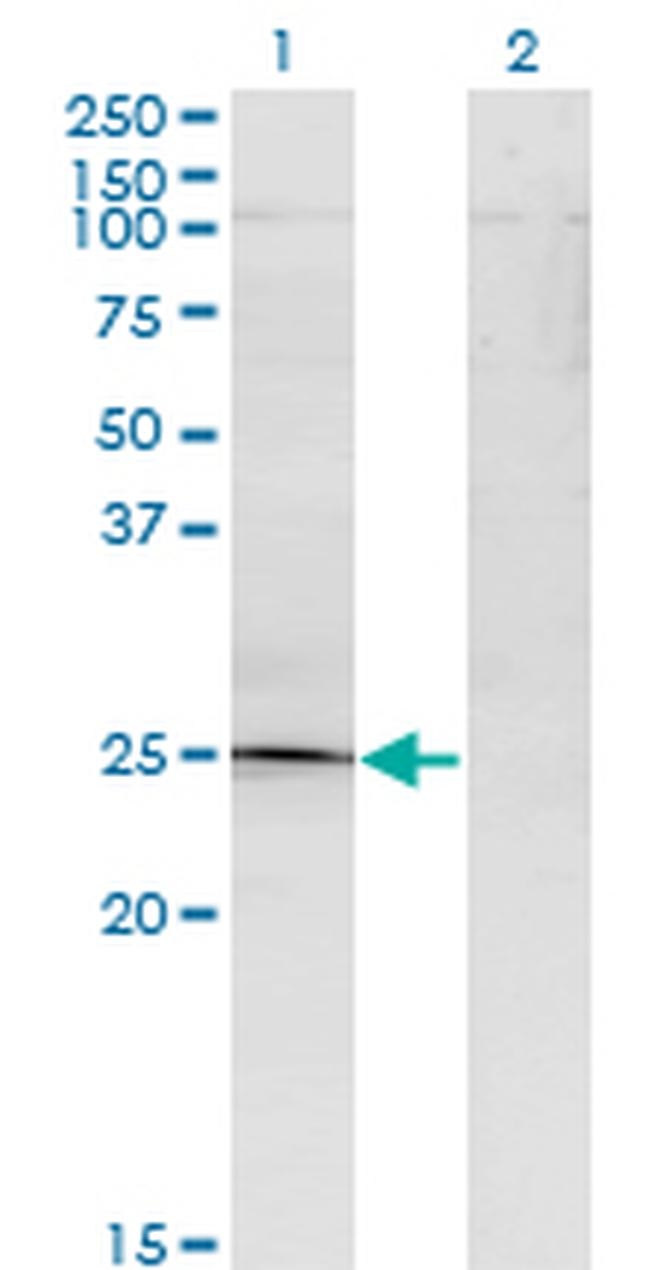 TGIF2 Antibody in Western Blot (WB)