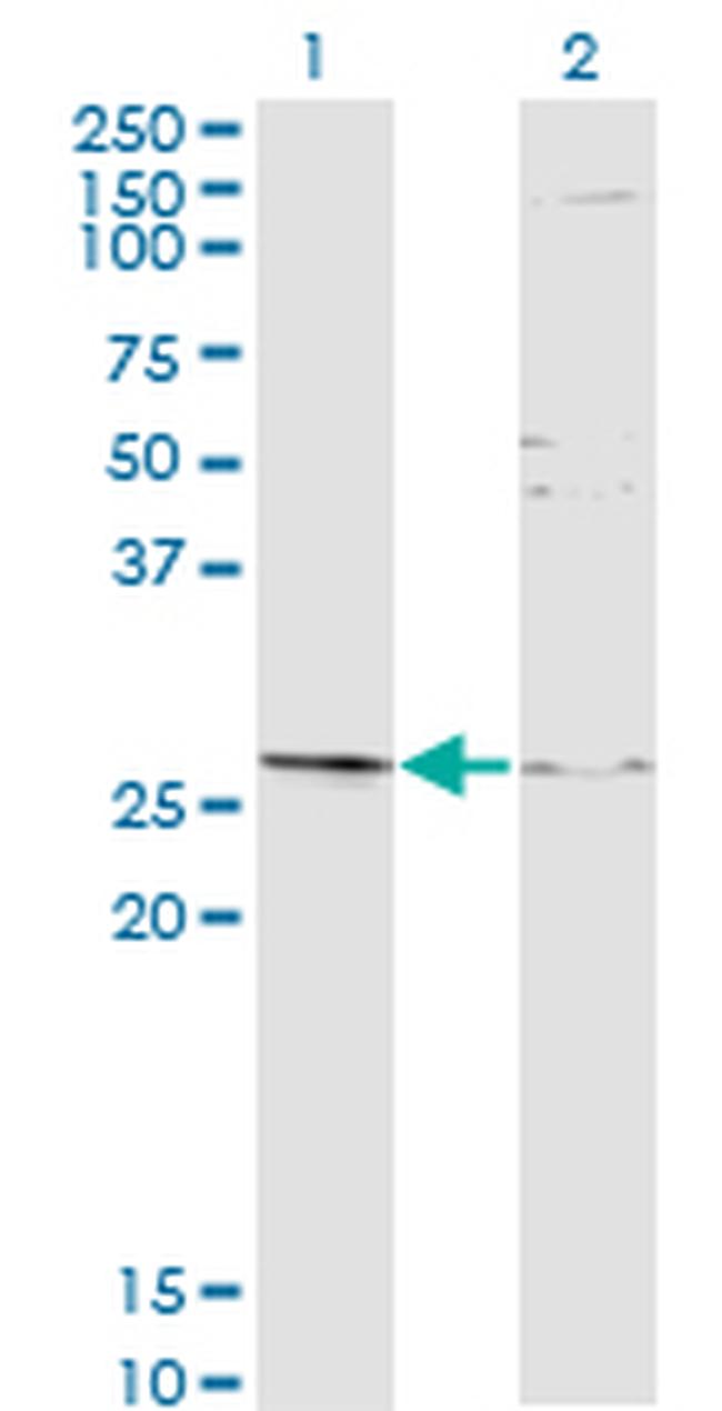 TGIF2 Antibody in Western Blot (WB)